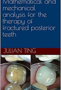 Mathematical and mechanical analysis for the therapy of fractured posterior teeth